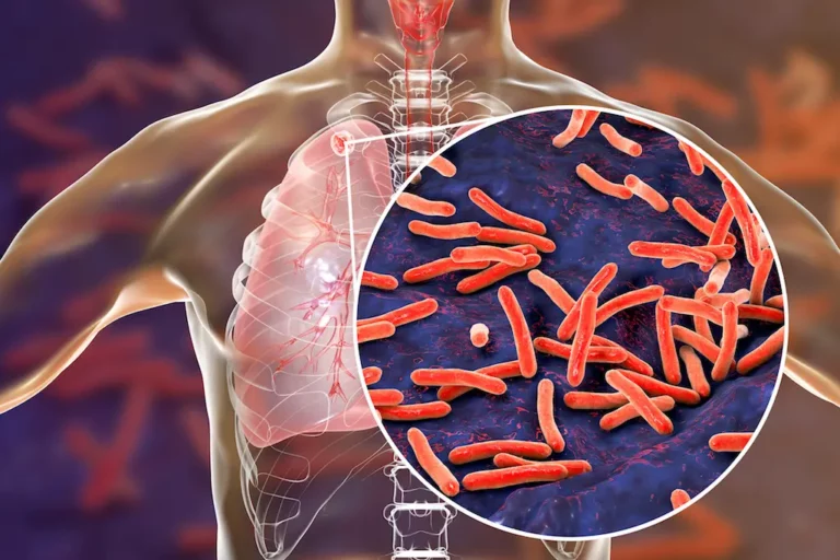 Facts About Tuberculosis